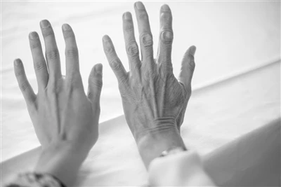 주사부터 채취까지: 진단에서 피하 주사바늘의 핵심 역할